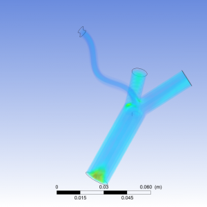 The Design - Blood Flow Simulation in Coronary Artery | ANSYS Fluent